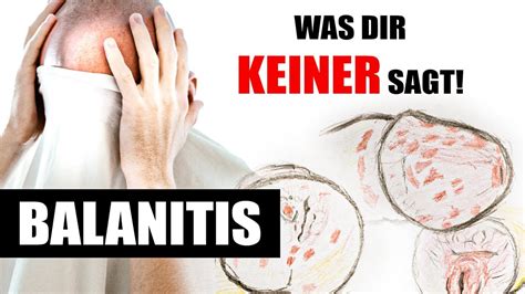 Balanitis: Entzündung der Eichel 